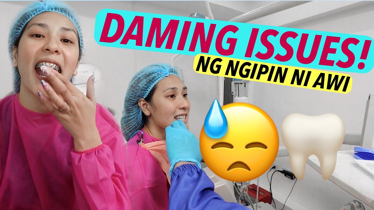 DAMING ISSUES NG NGIPIN KO! Braces Again   Smile and style by Dr Rain + Lauvin