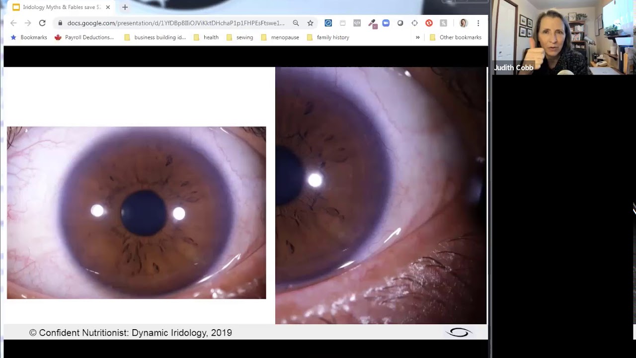 Wanna Learn Iridology? Here are all the details!