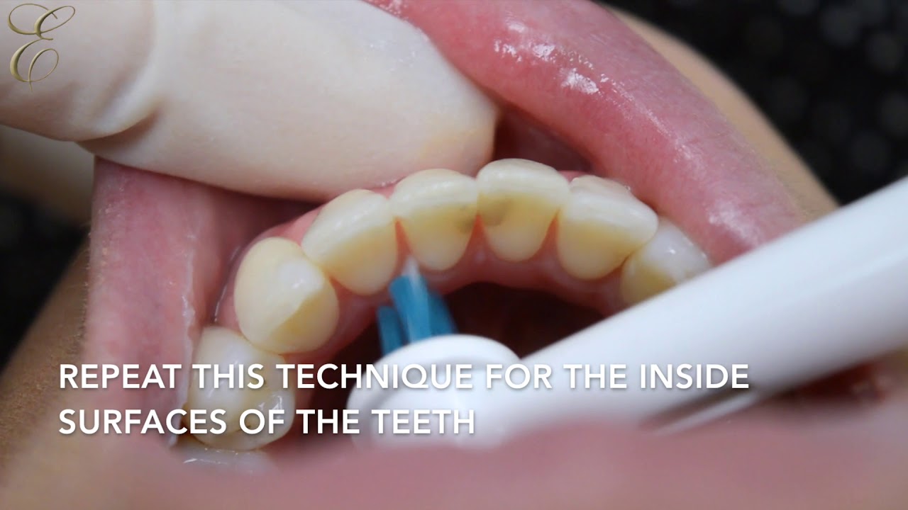 How to use Interspace electric toothbrush properly