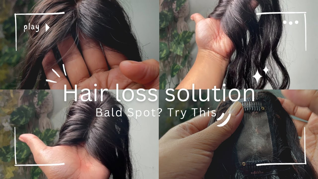 Hair Topper for Bald Spots? Honest Review | Hair Loss ka Solution 💇‍♀️ 