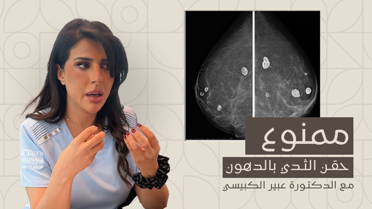 مخاطر حقن الثدي بالدهون بهدف التكبير - قصة مريضتنا مع الدكتوره عبير الكبيسي