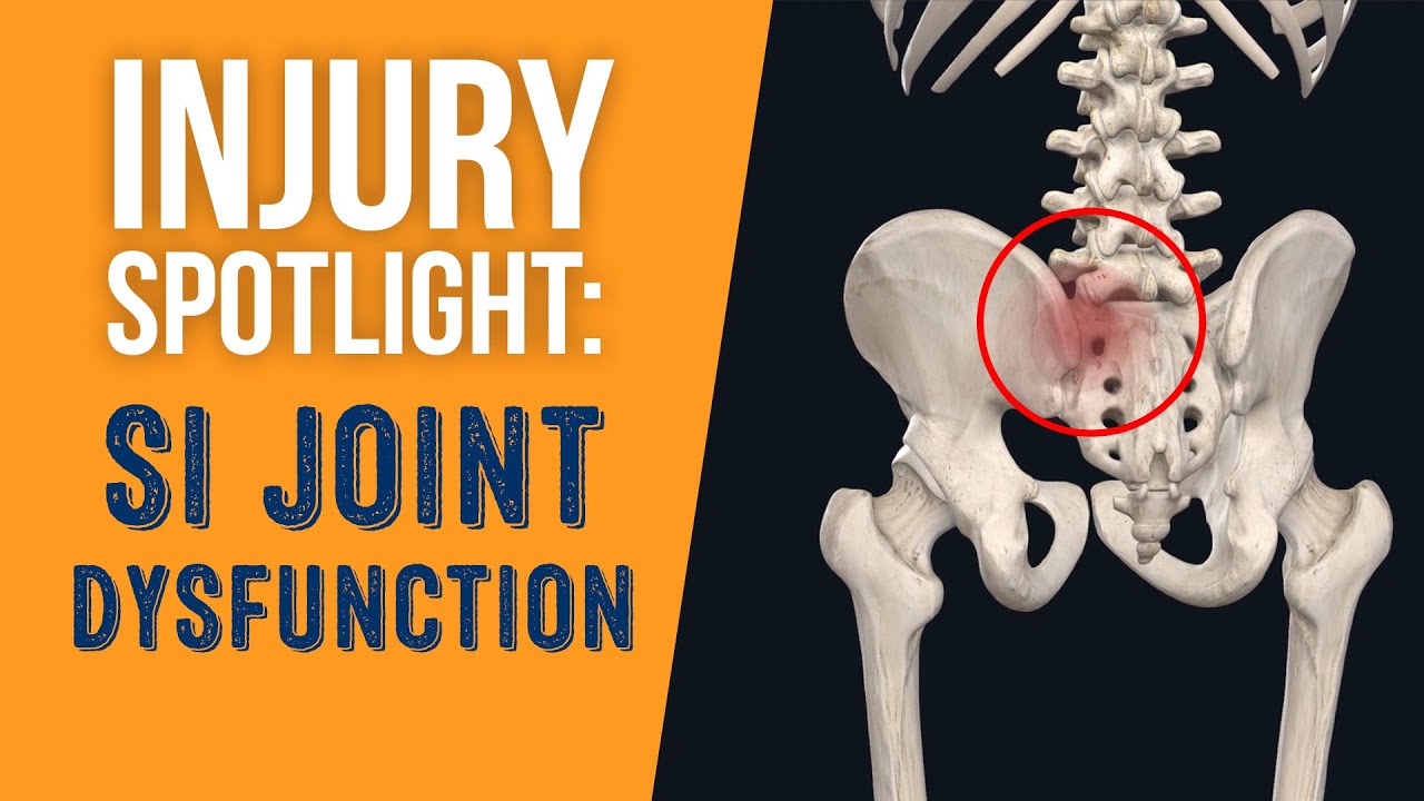 What is SI (Sacroiliac) Joint Dysfunction?