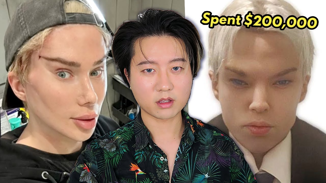 Подражатель пластической хирургии Оли Лондона