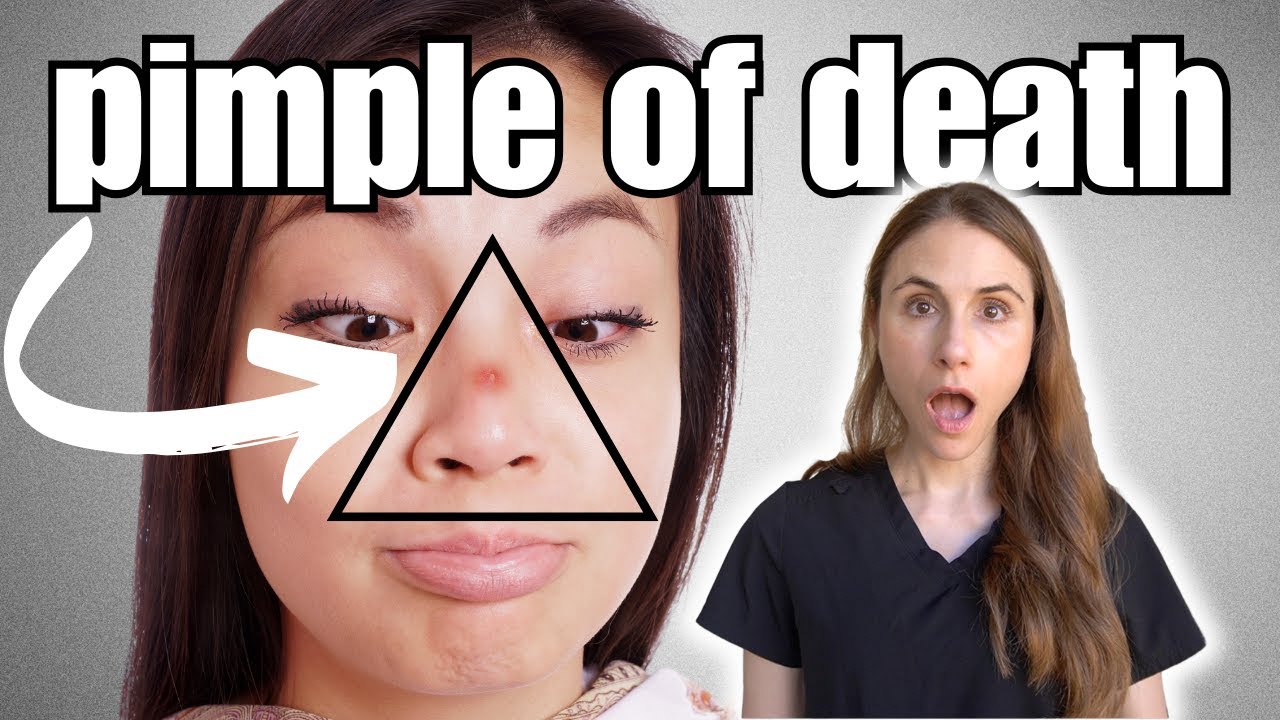 The Hidden Danger Of Popping Pimples On The Face