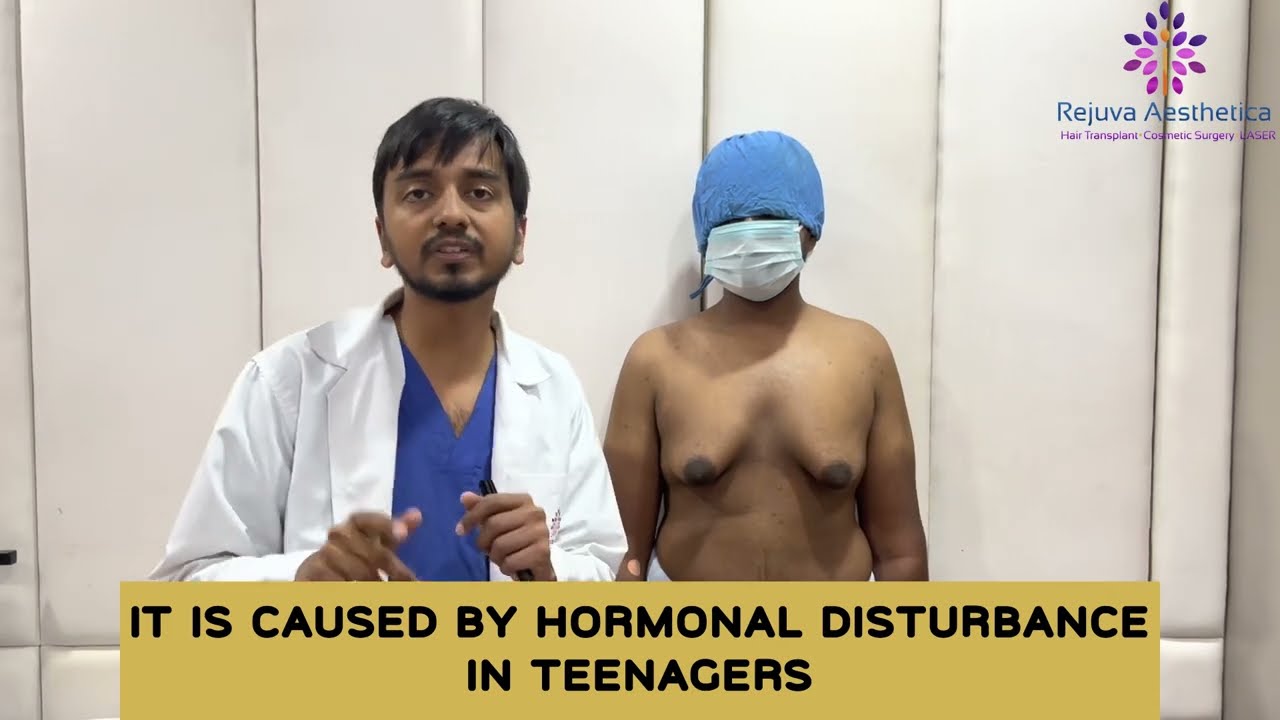 Can Teenage gynecomastia be cured by exercising, proper diet and Medication ? #shorts #gynecomastia