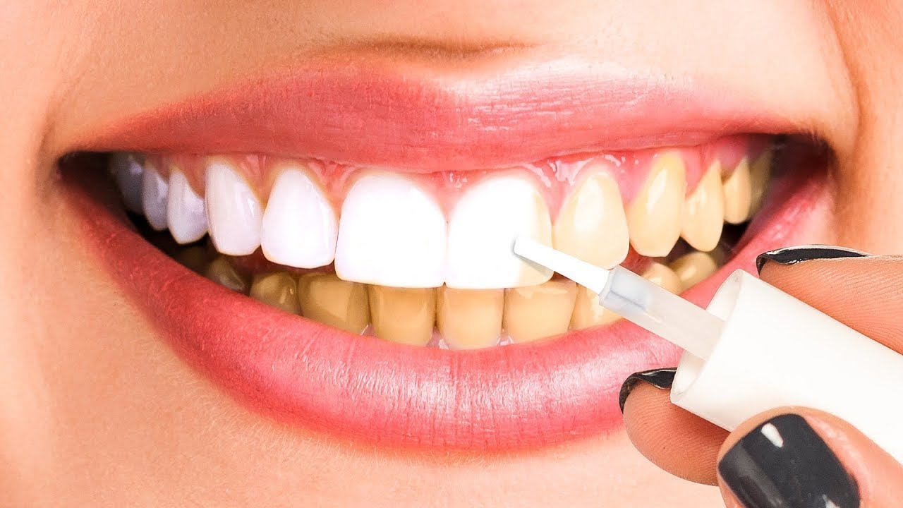 あなたをハリウッドスターのように見せる34のお金のかからない裏技