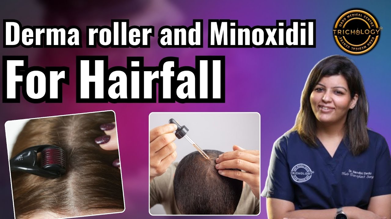 Derma roller and Minoxidil For Hairfall | Hair Transplant Clinic  | Dadu Medical Centre