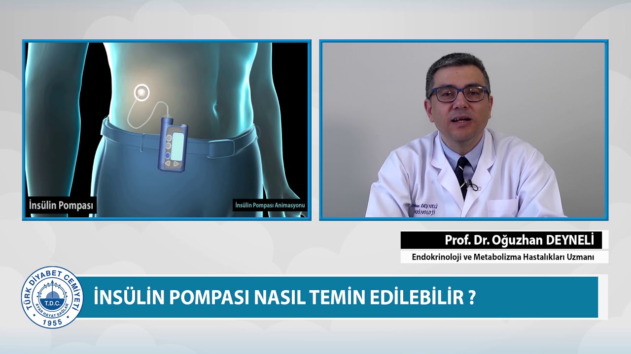 İnsülin pompası nasıl temin edilebilir?