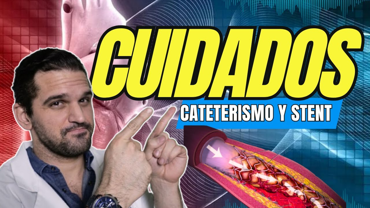 ¡Después del Stent: Cuidados CRUCIALES para tu Corazón! 💯