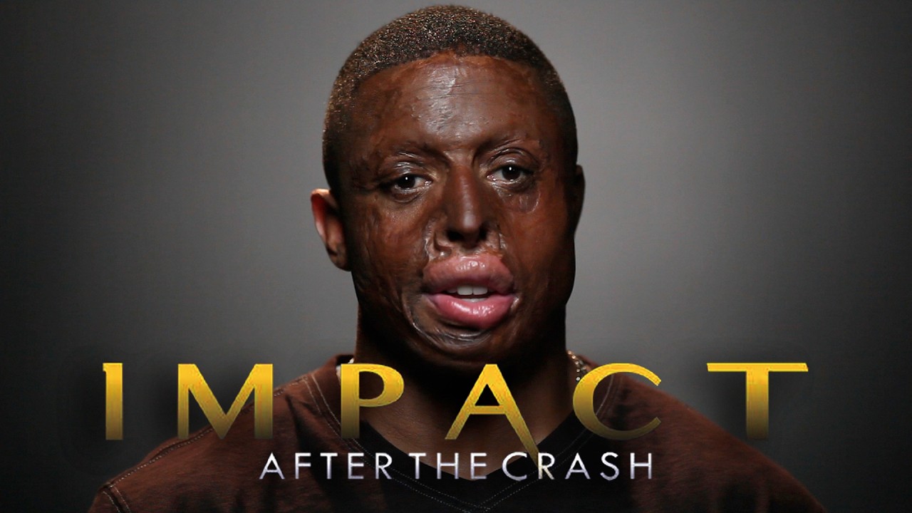 Impact After The Crash (2017) | Full Movie | Documentary