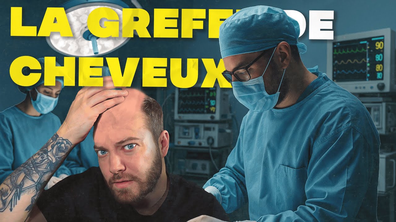 Greffe de Cheveux : Mon expérience