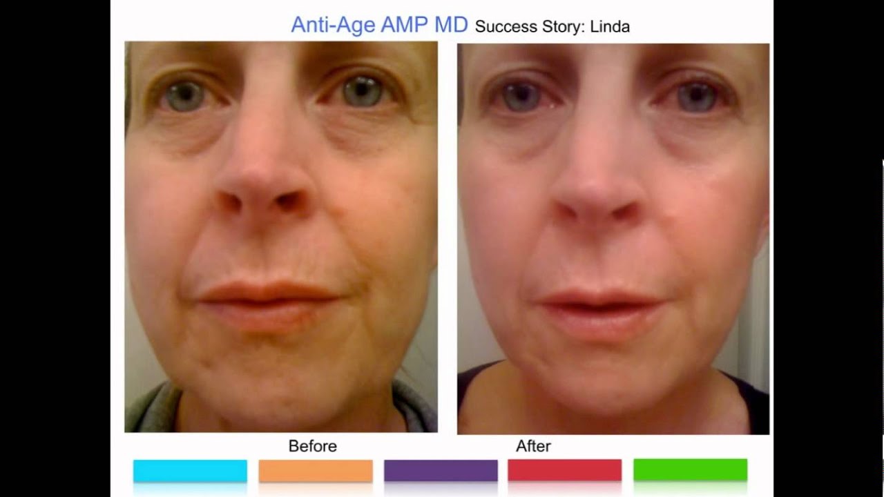 Anti Age Regimen Before and after Pictures