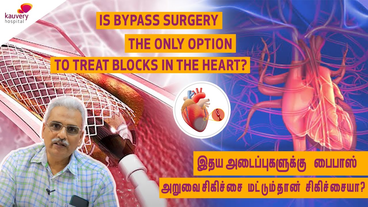 Is bypass surgery the only option to treat blocks in the heart?