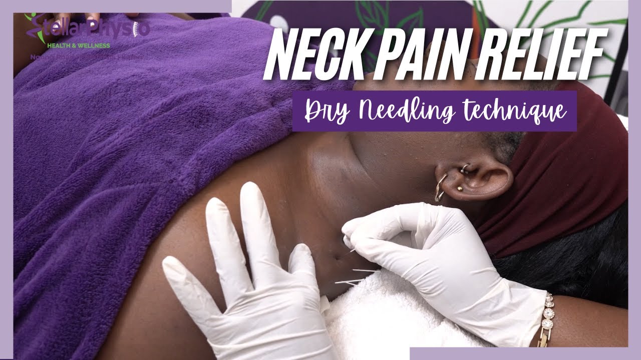 Chronic Neck Pain GONE! The Dry Needling Secret for LASTING Relief (It's Not a Massage!)
