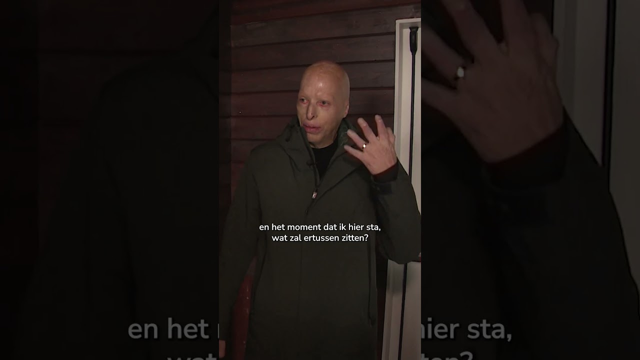 25 jaar geleden overleefde Lou de Nieuwjaarsbrand in Volendam