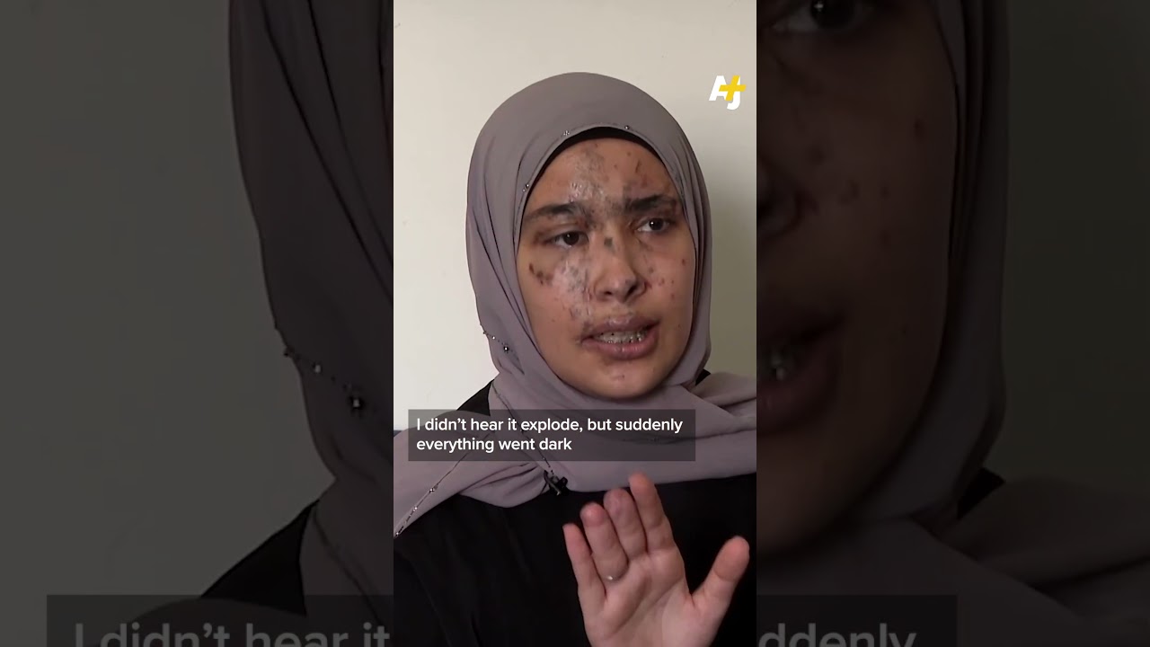 Survivors of Lebanon Pager Attacks, 1 Year Later