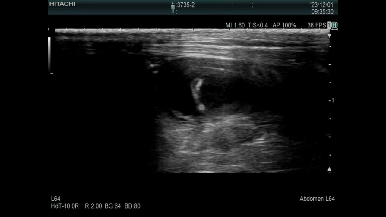 Urinary bladder（6ｍｍ） Mass（4ｍｍ）？  in a guinea pig　 モルモットの膀胱（6mm)内のマス？（4mm）