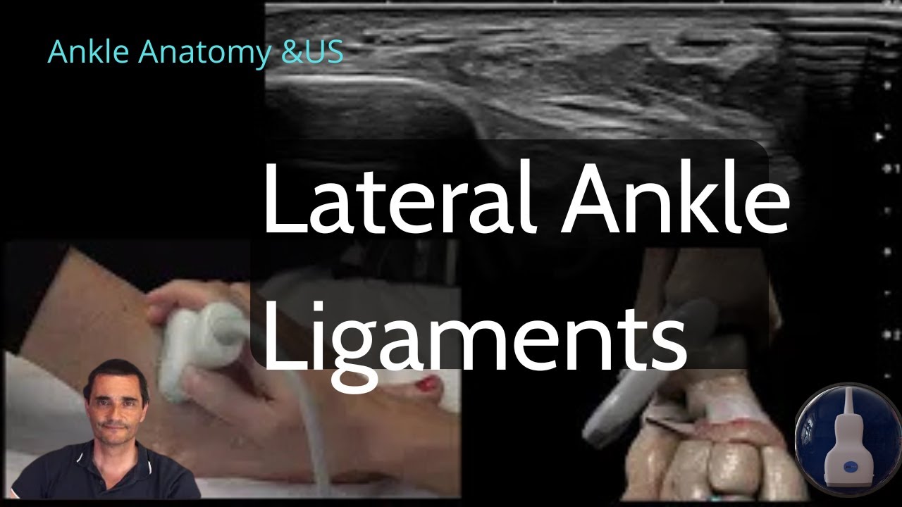 LATERAL ANKLE LIGAMENTS | Real-Time Ultrasound Demo with Tips & Troubleshooting