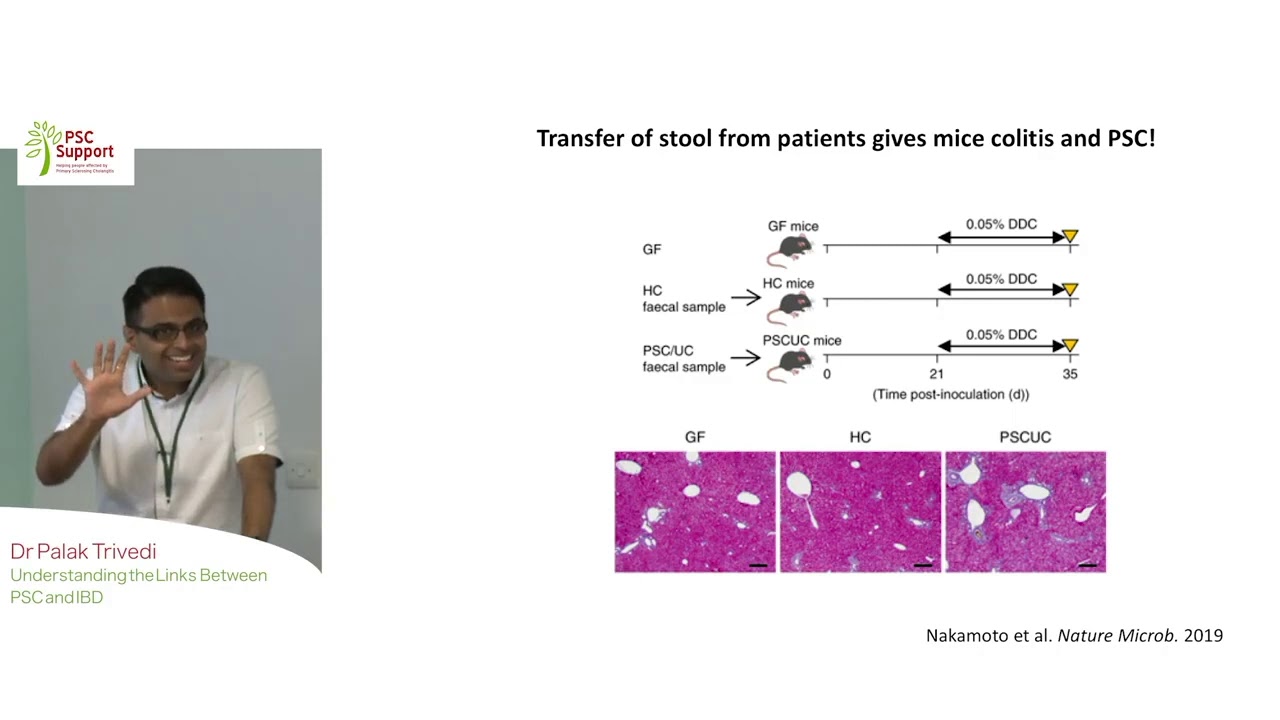 Dr Palak Trivedi - Understanding PSC and IBD (PSC Support)