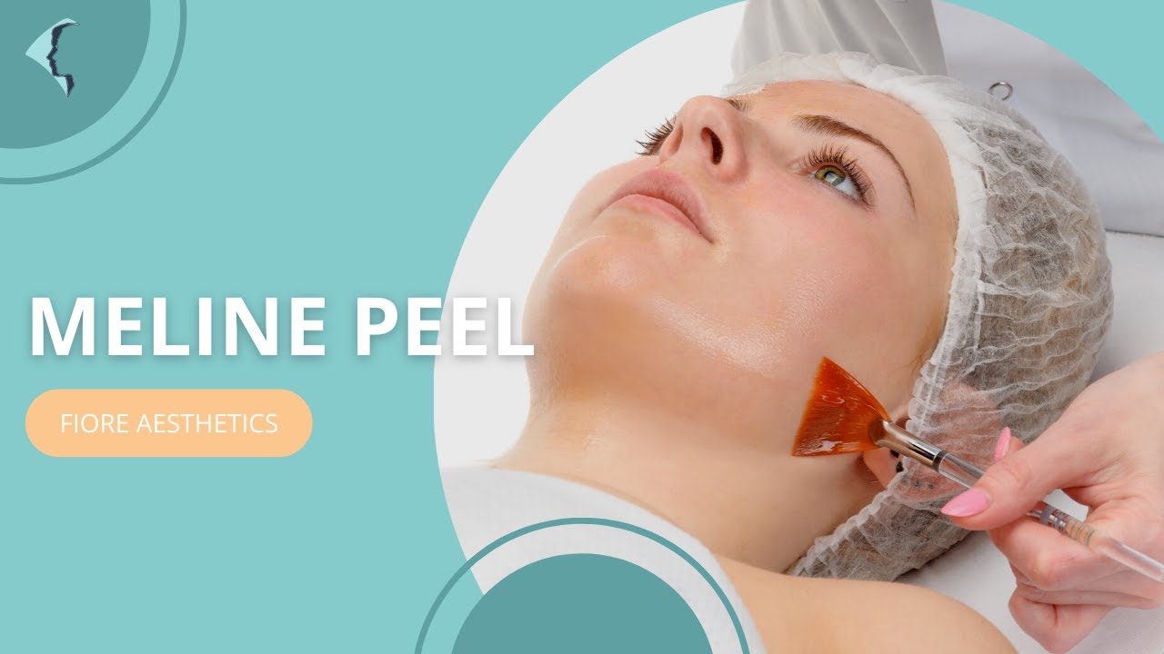 Clinica Fiore Skin Clinic London MELINE Peel