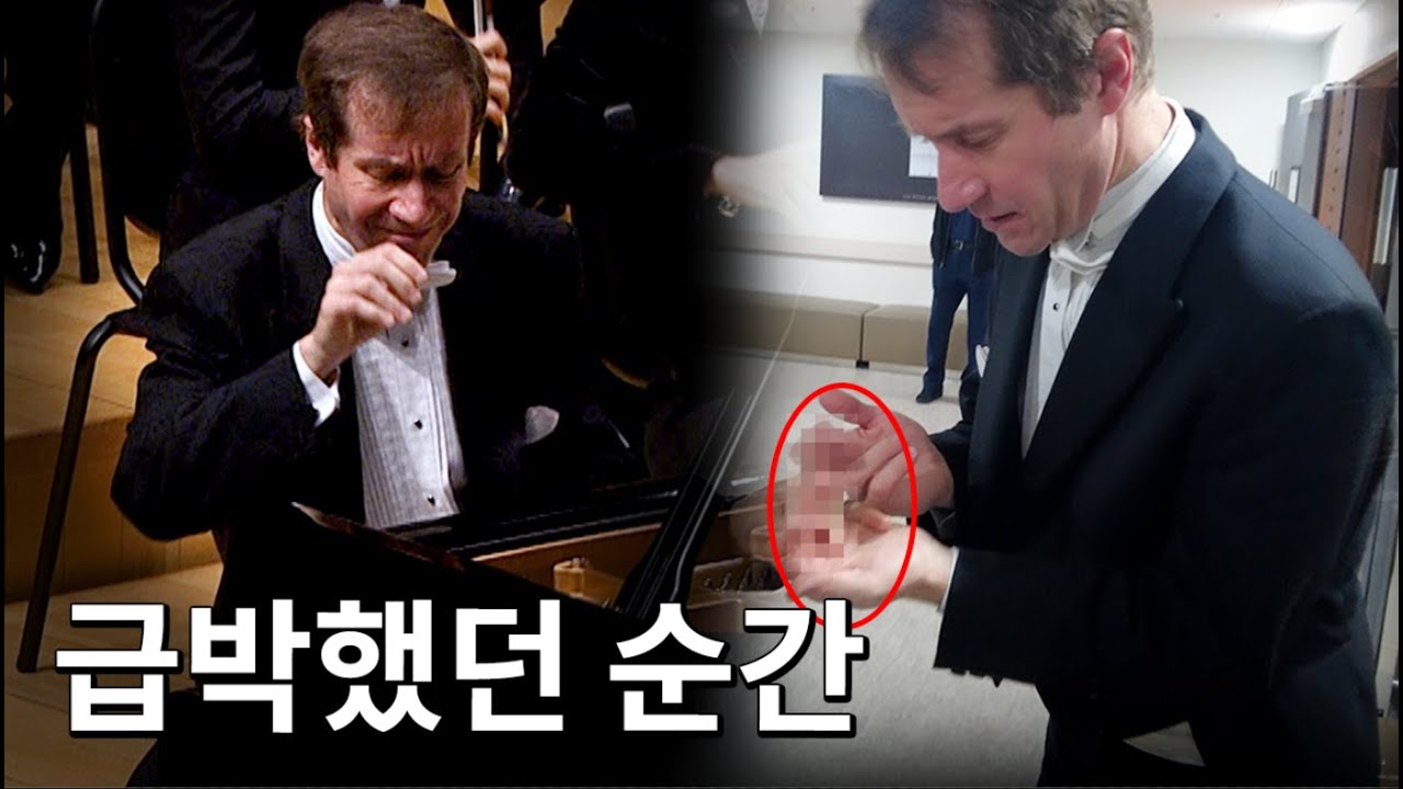 전국 생중계 방송 공연에 피아니스트 손가락이 찢어졌습니다