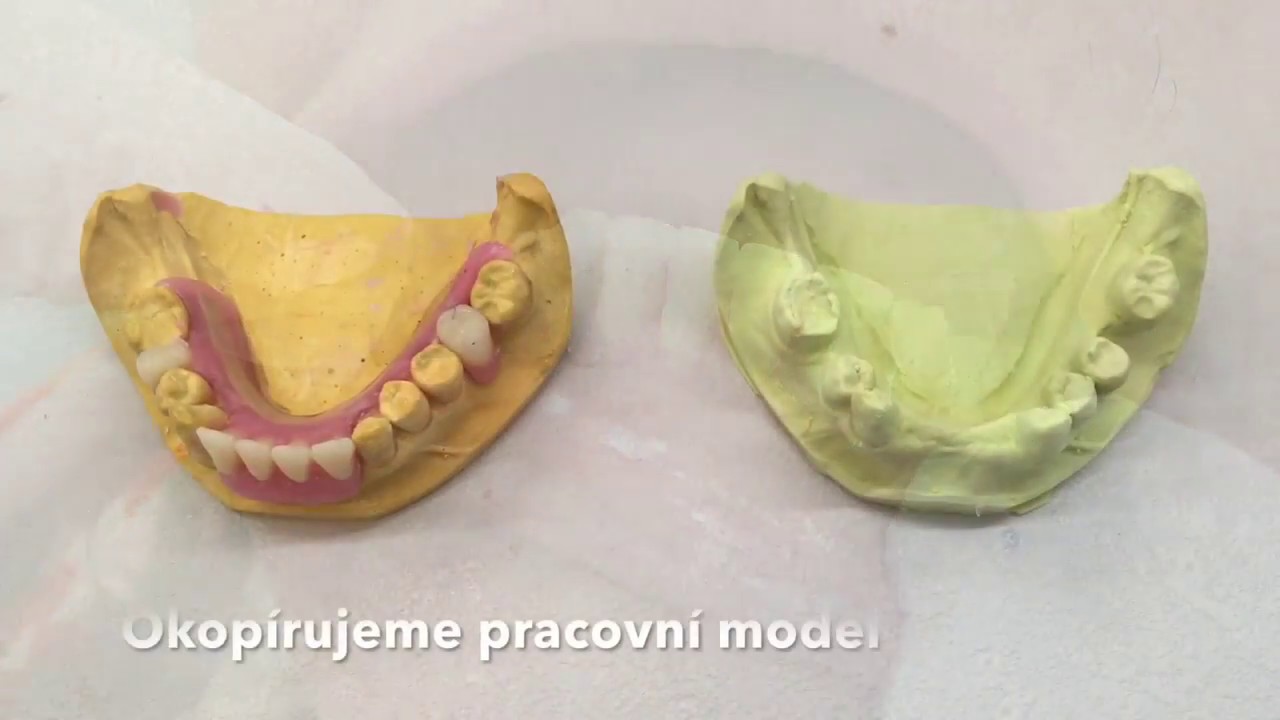 Pružné protézy Vivaflex