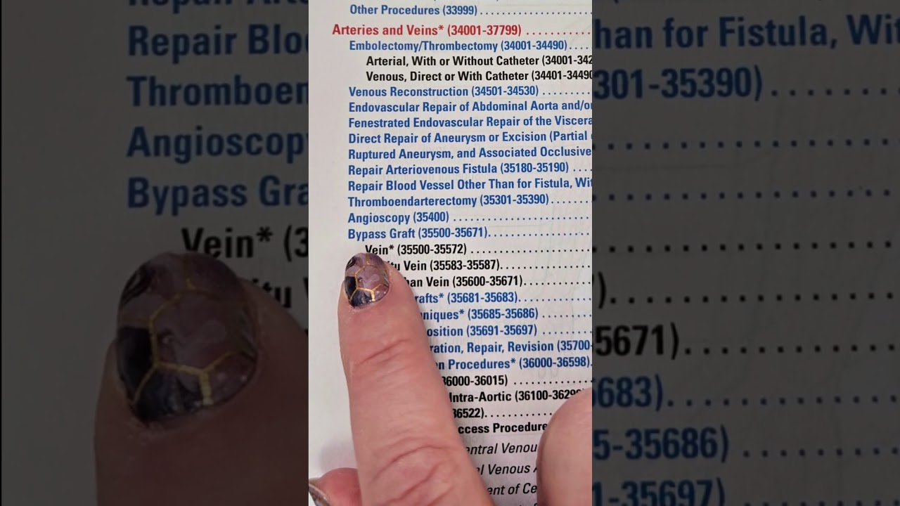 Medical Coding Demonstration - How to look up a CPT code for a bypass graft #medicalcoding