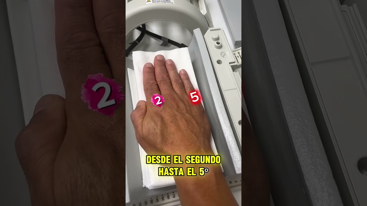 Posicionamiento en RM Mano versus RM Dedo