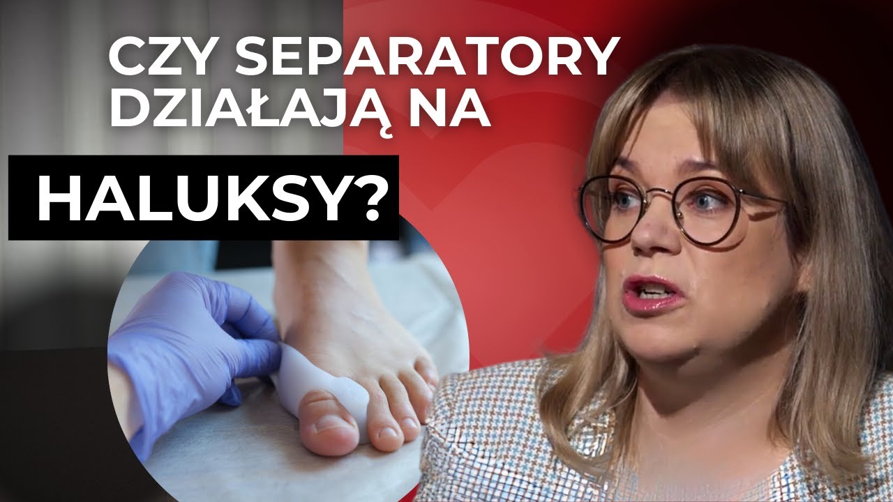 Czy separatory działają na haluksy? Fizjoterapeutka o najlepszych sposobach na wyprostowanie stóp