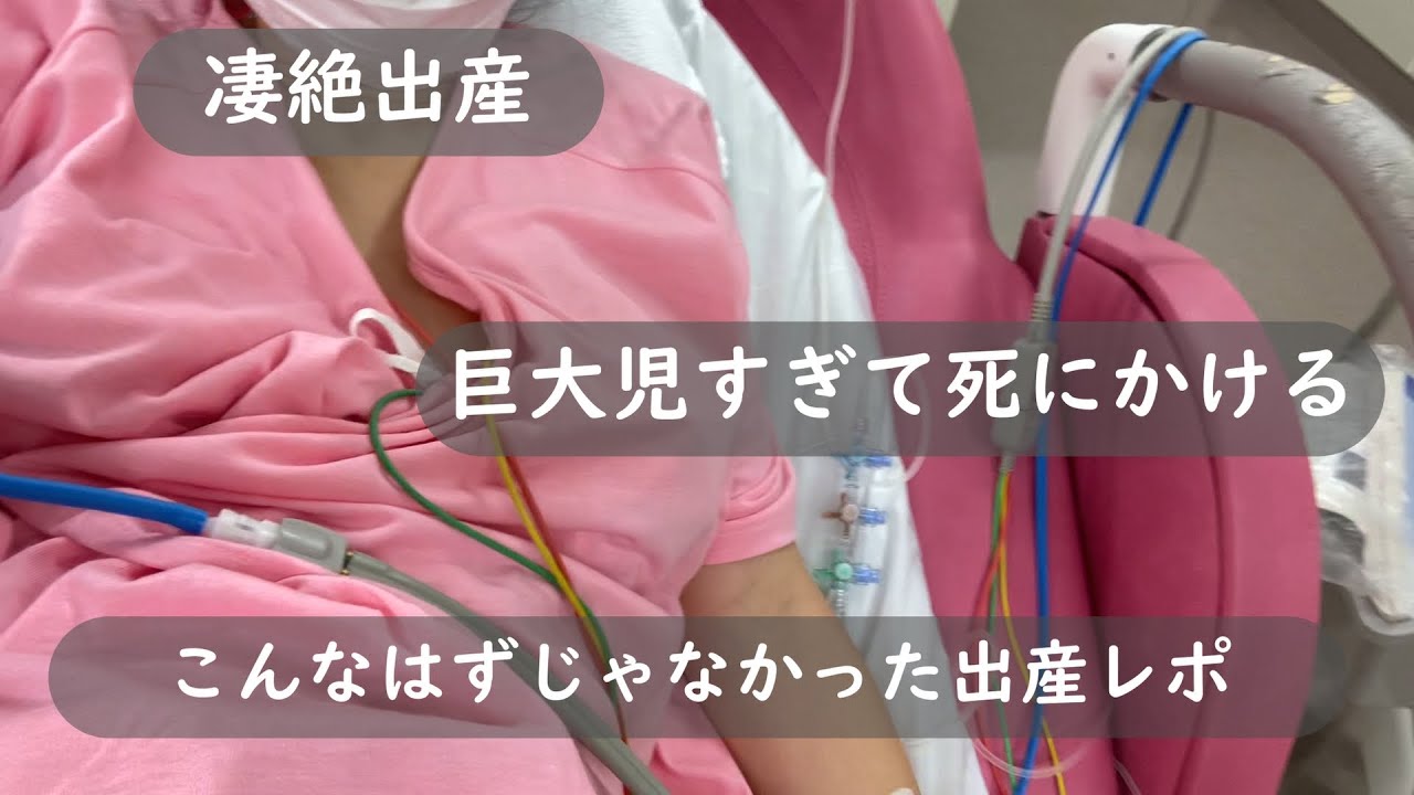 【無痛分娩】【出産レポ】凄絶出産　４キロ越えの巨大児出産で死にかけて