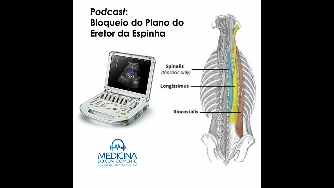 Bloqueio do plano do eretor da espinha