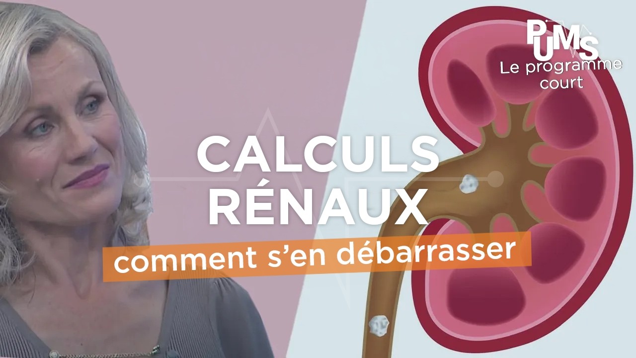 Comment éliminer les calculs rénaux (dans les reins) pour une meilleure santé ?