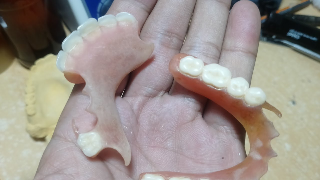 Dentures Stain Flexible Dentures.