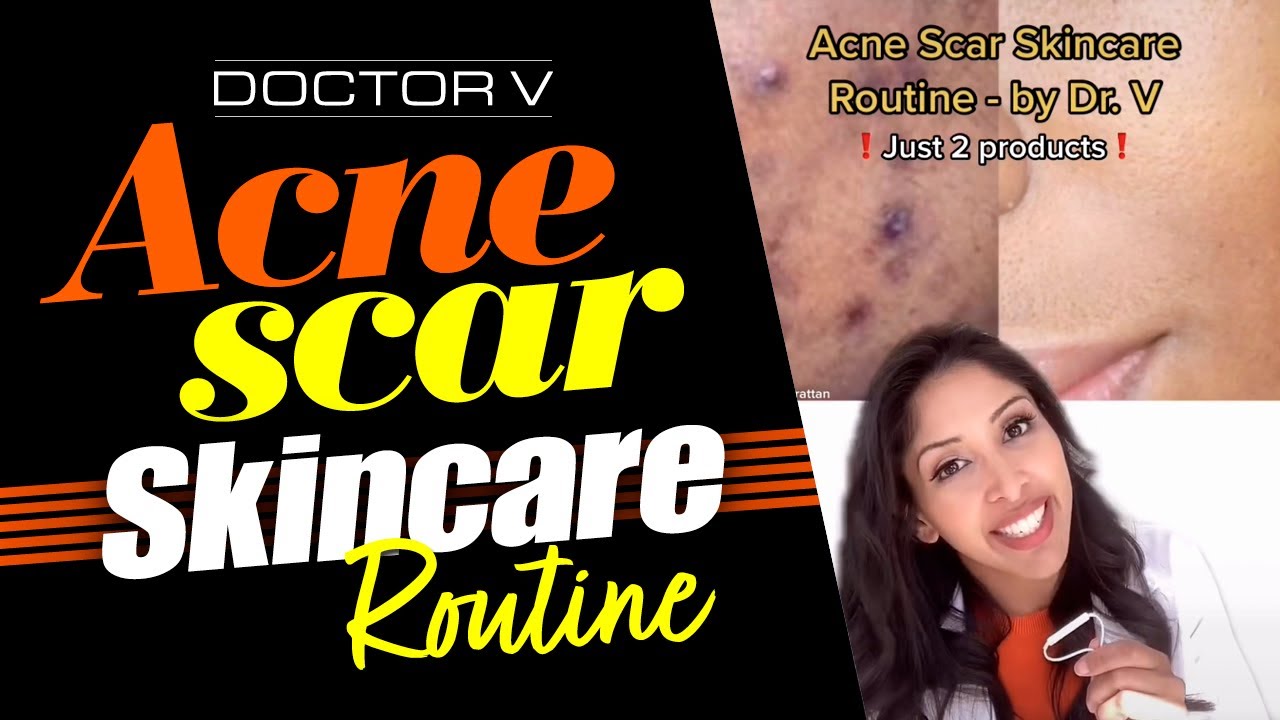 Doctor V - Acne Scar Skincare Routine | Skin Of Colour | Brown Or Black Skin | #shorts