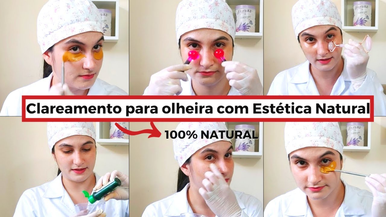 Tratamento de olheira com estética natural (100% natural)