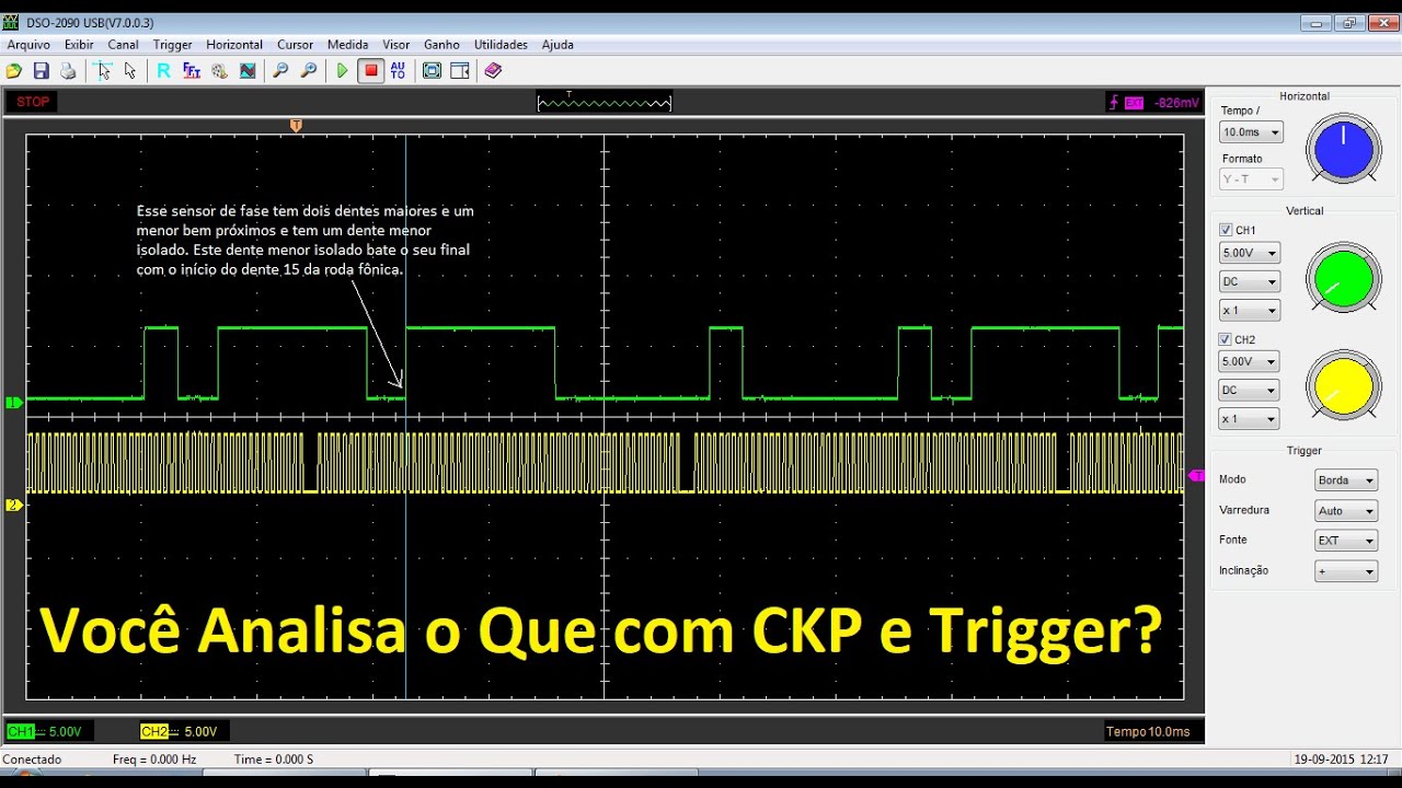 Você analisa o Que? Sinal CKP e Trigger.
