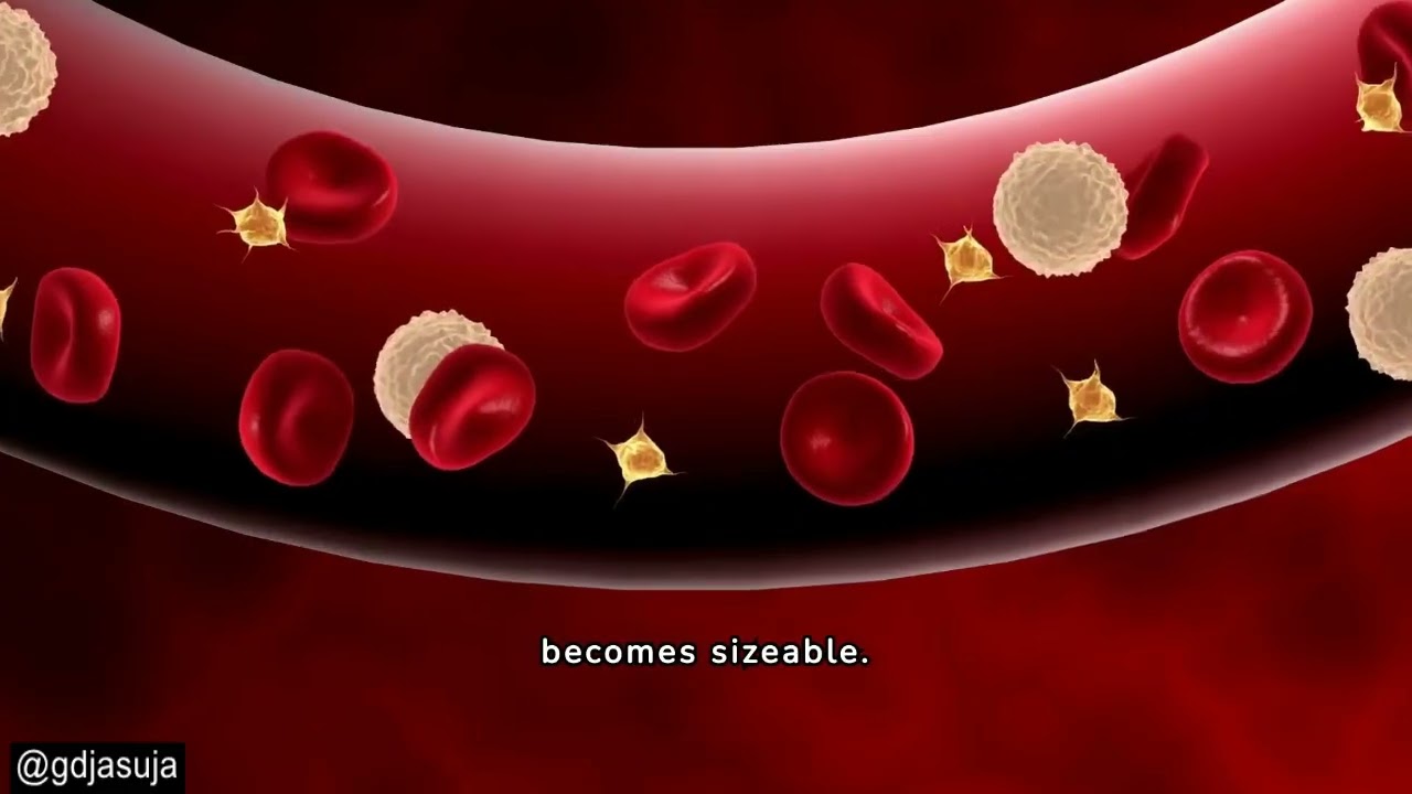 Safety Issues of AstraZeneca's Covishield Vaccine for COVID-19
