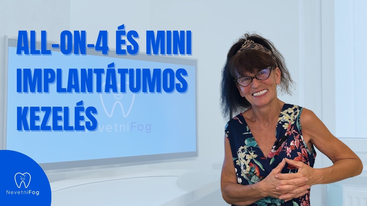 All-on-4 &eacute;s Mini implant&aacute;tumos fogsor | &ldquo;Itt vissza fogja nyerni a bizalm&aacute;t&rdquo; | NevetniFog