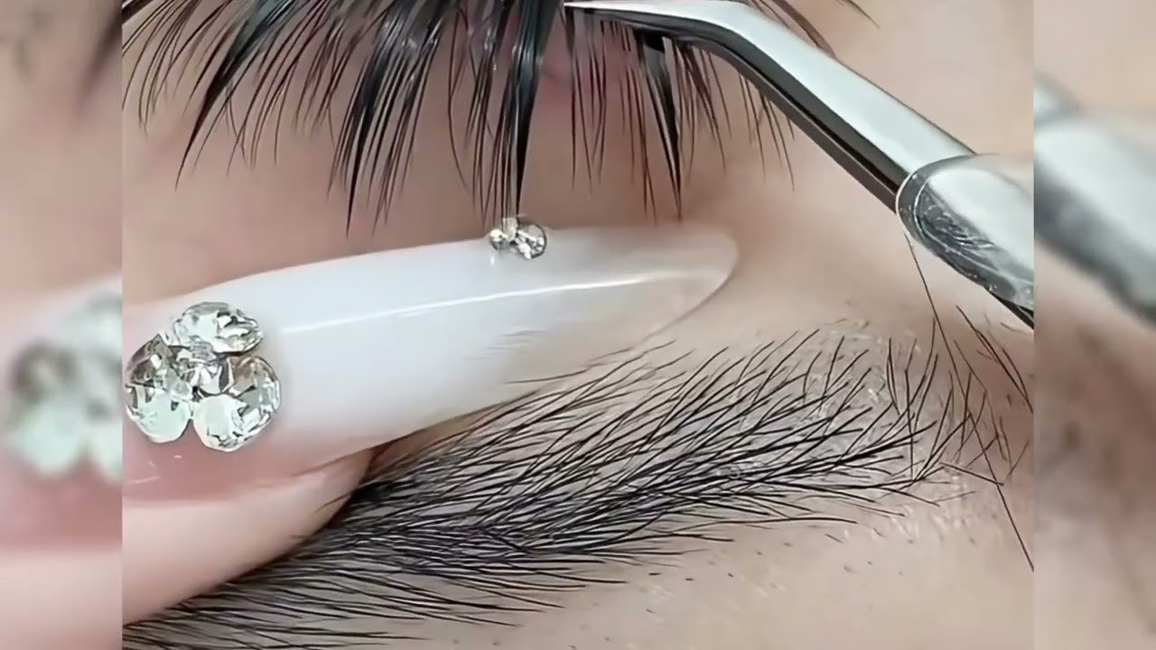 NỐI MI ĐA TẦNG