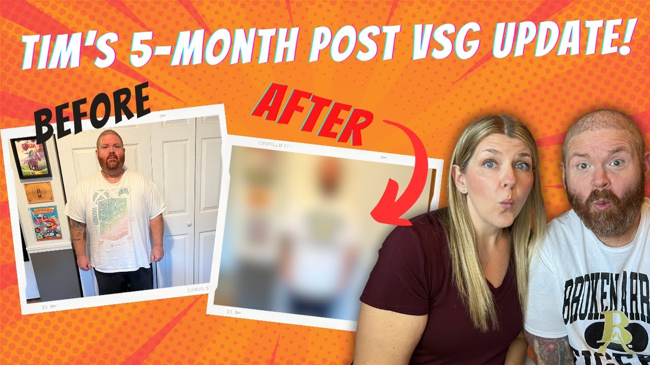 5 Months After VSG Surgery… What’s Actually Changed? | Men’s Bariatric Update