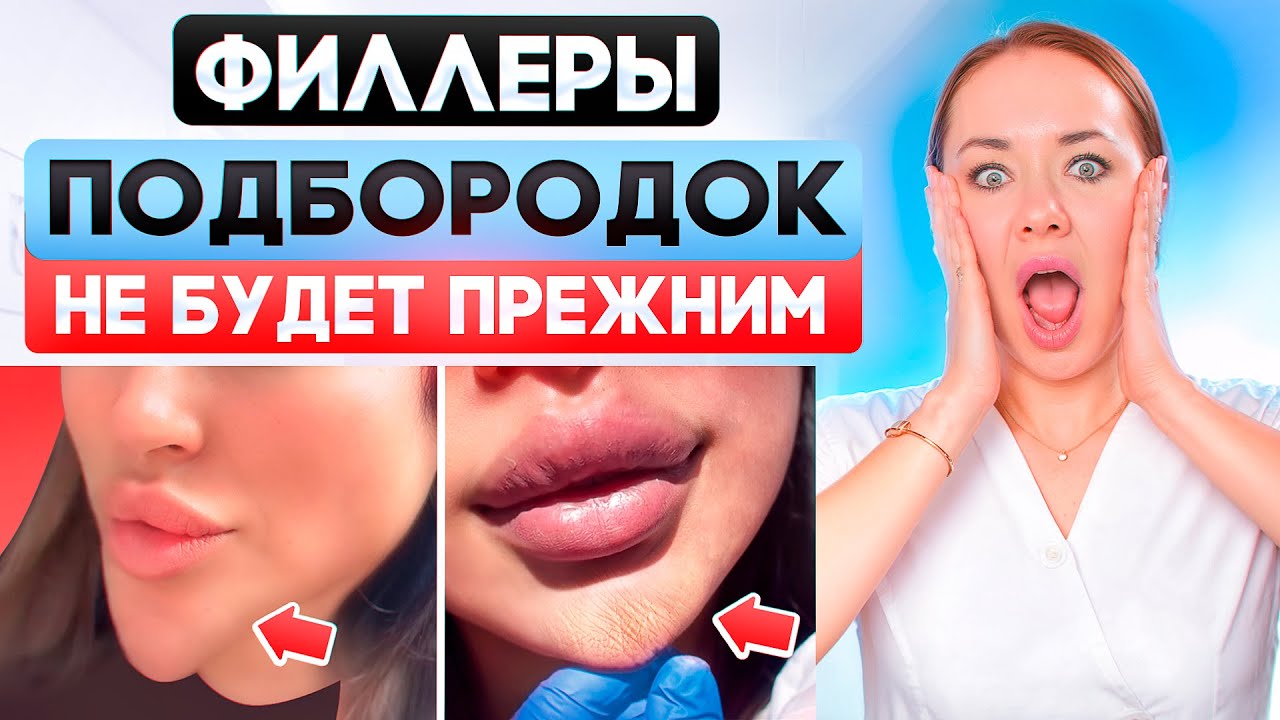 Филлеры — это опасно? Последствия филлеров в подбородок.