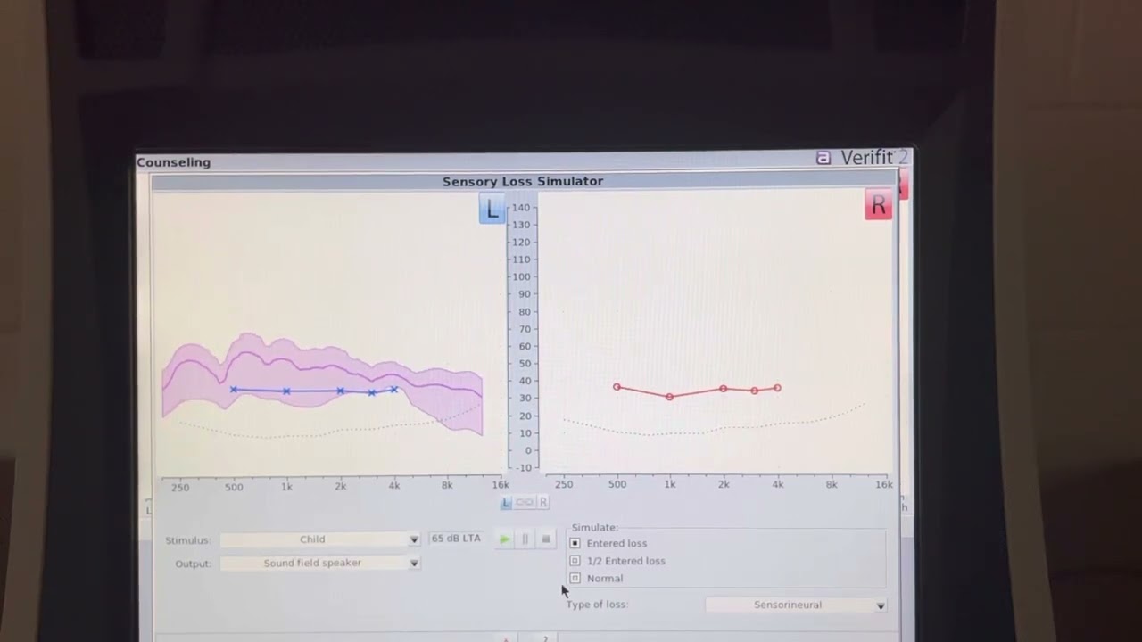 Verifit hearing simulation and Speech Intelligibility Index scores