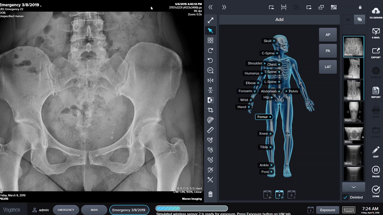 How to Acquire a new X-ray