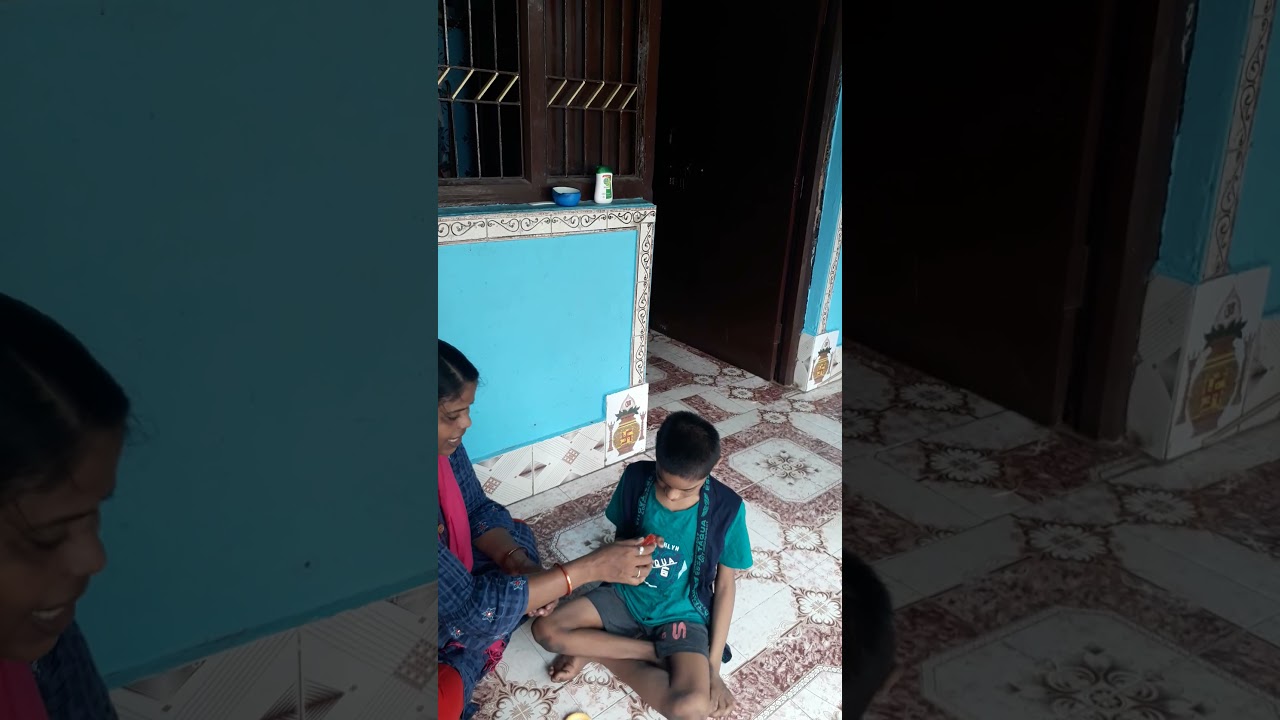 Physiotherapy for CP child