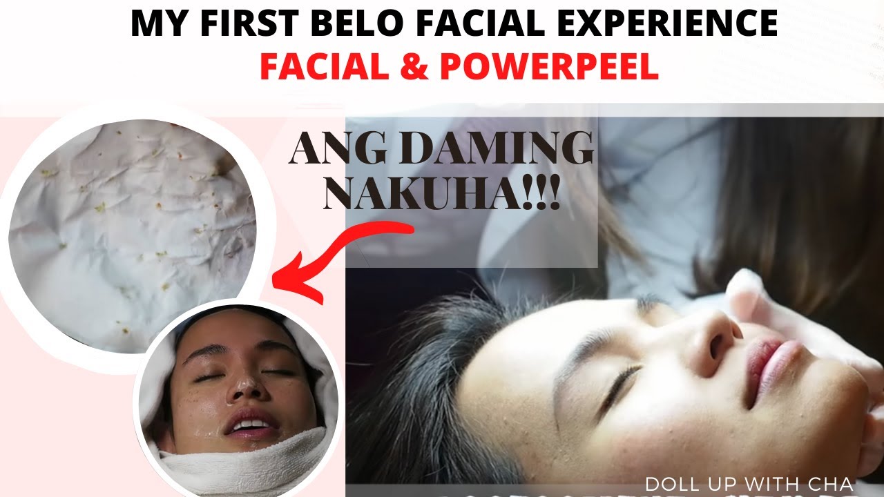 My 1st Belo Facial Treatment & Power Peel Experience | Filipino Celebrity Dermatologist