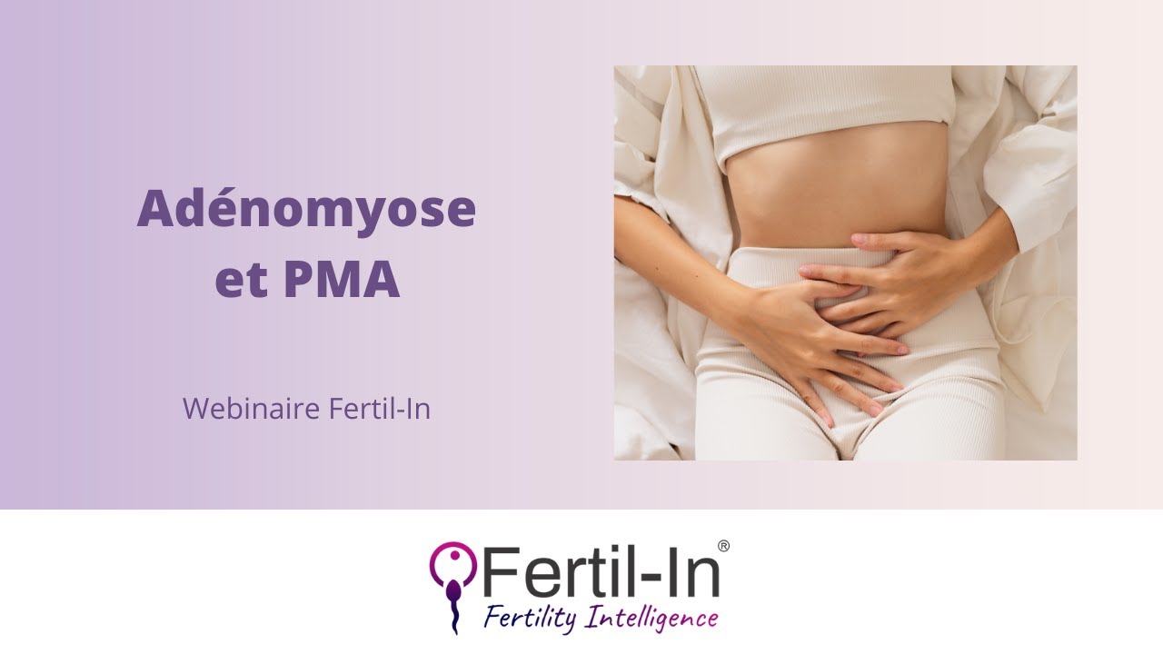 Webinaire: Adénomyose et PMA