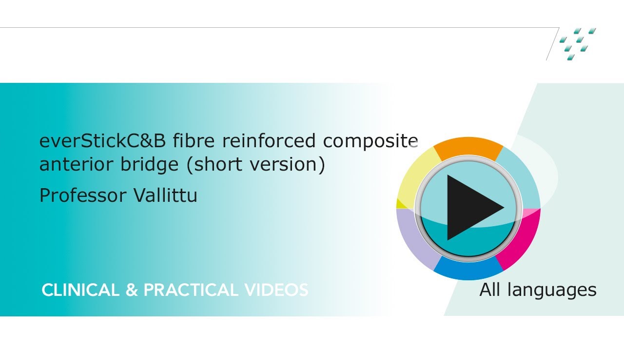 everStickC&B fibre reinforced composite anterior bridge by Pekka K. Vallittu (short version)