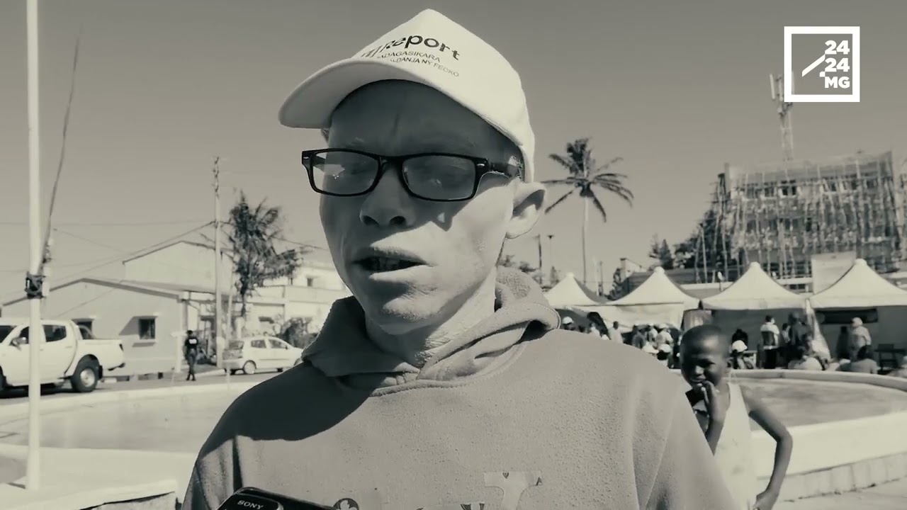 SOCIETE – Le quotidien difficile des personnes atteintes d'albinisme dans le Sud de Madagascar