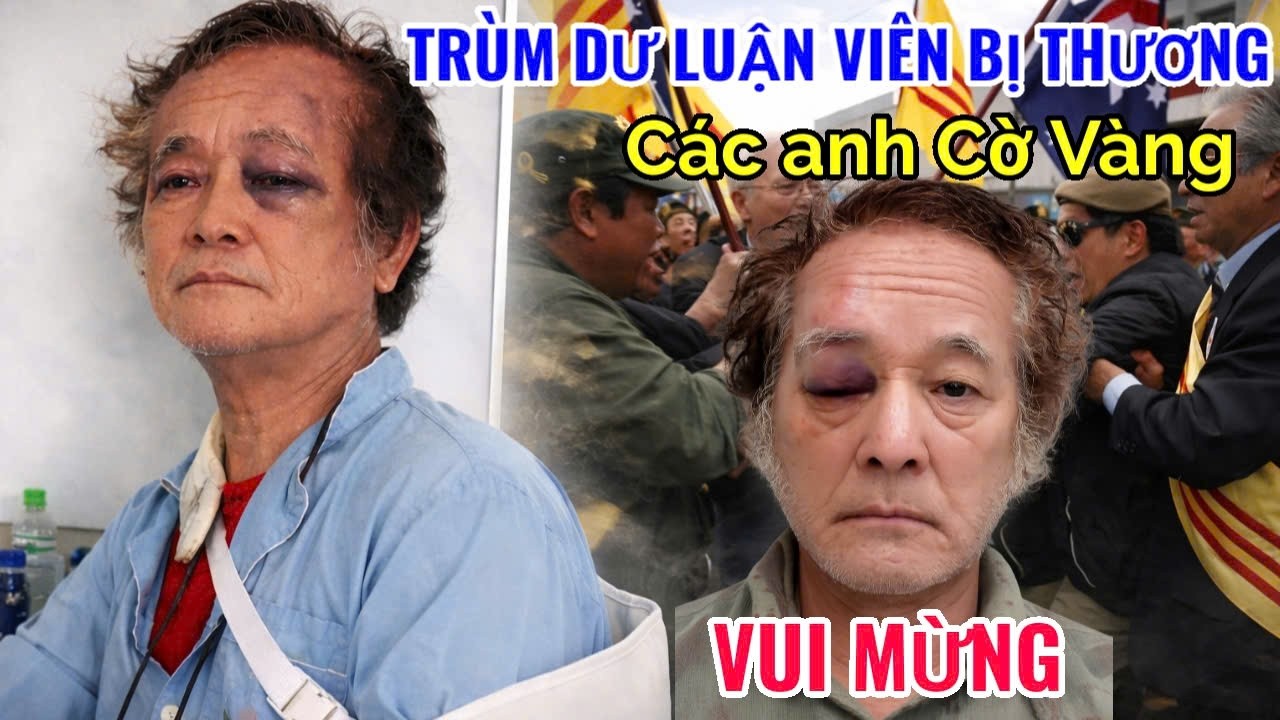 Trùm DLV Cờ đỏ Trần Nhật Quang bị O.ánh? Các anh Cờ Vàng vui mừng #vietvision