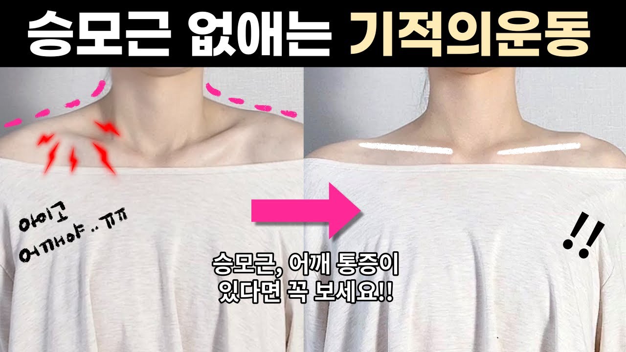하루 딱 5분만 하세요👌🏻승모근이 거짓말처럼 편해집니다 l 일자쇄골, 직각어깨, 어깨통증